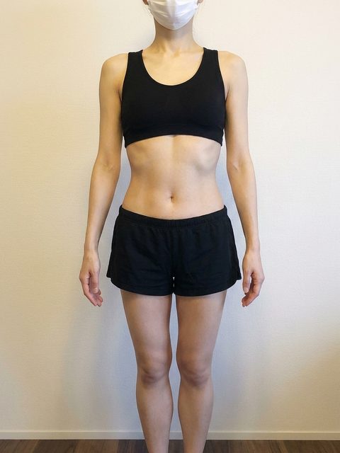 Case 1 after 3 months of treatment