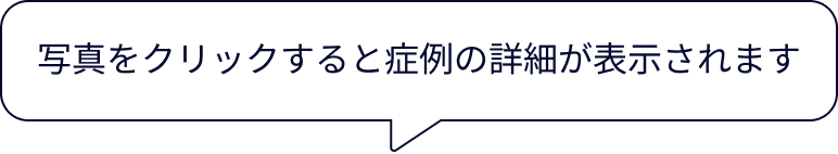 写真をクリックすると症例の詳細が表示されます