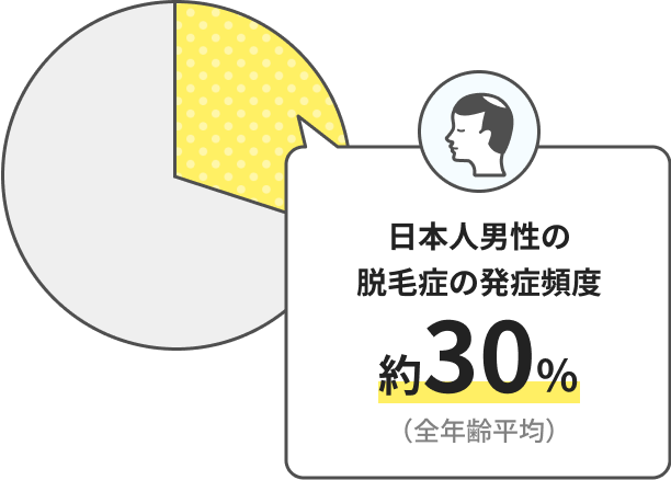 日本人男性の脱毛症の発症頻度 約30％（全年齢平均）