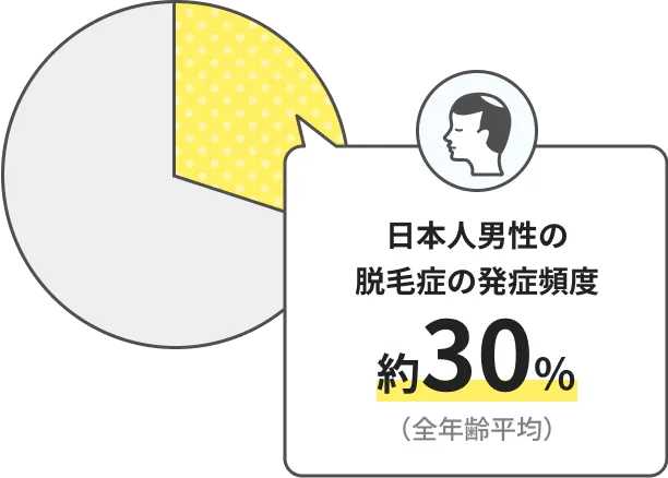 日本人男性の脱毛症の発症頻度 約30%(全年齢平均)